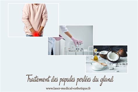 papule perlée|LES PAPULES PERLEES DU GLAND